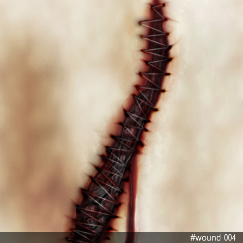 wound004.jpg
