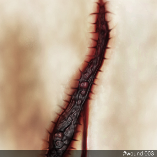 wound003.jpg