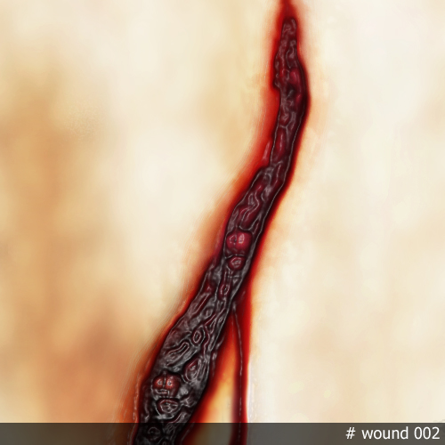 wound002.jpg