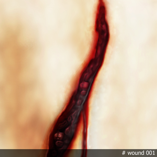 wound001.jpg